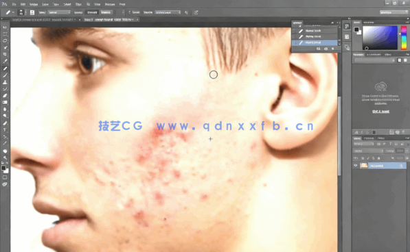 PS人像面部粉刺疤痕瑕疵美容去除处理视频教程(图1)