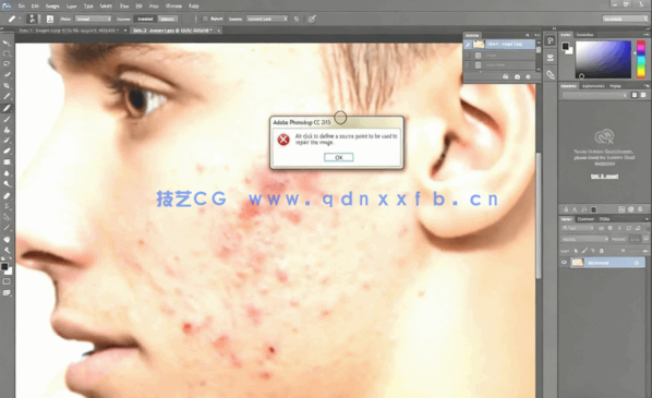 PS人像面部粉刺疤痕瑕疵美容去除处理视频教程(图3)